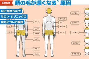 【医師監修】頬の毛が濃くなる原因は？処理するなら剃る？抜く？サロン・クリニックの脱毛も解説