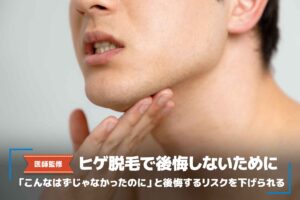 【医師監修】ヒゲ脱毛の失敗例7選！後悔・失敗しないための対策とは