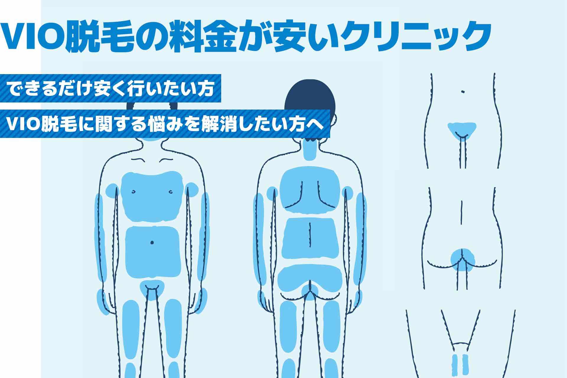 VIO脱毛の料金が安いおすすめのクリニック！安い以外にも重要な選び方も解説